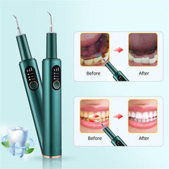 Ultrasonic Dental irrigator