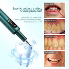 Ultrasonic Dental irrigator