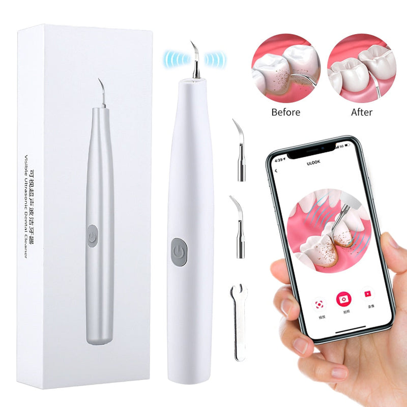 Ultrasonic Dental Cleaning  - SMART controlled