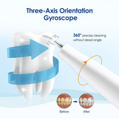 Ultrasonic Dental Cleaning  - SMART controlled